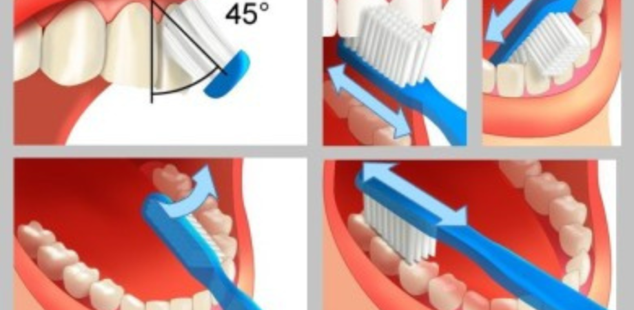 Bien se brosser les dents Dentiste à Fès Dentiste champs de course Dentiste atlas Dentiste centre ville Dentiste prix consultation medecin dentiste maroc