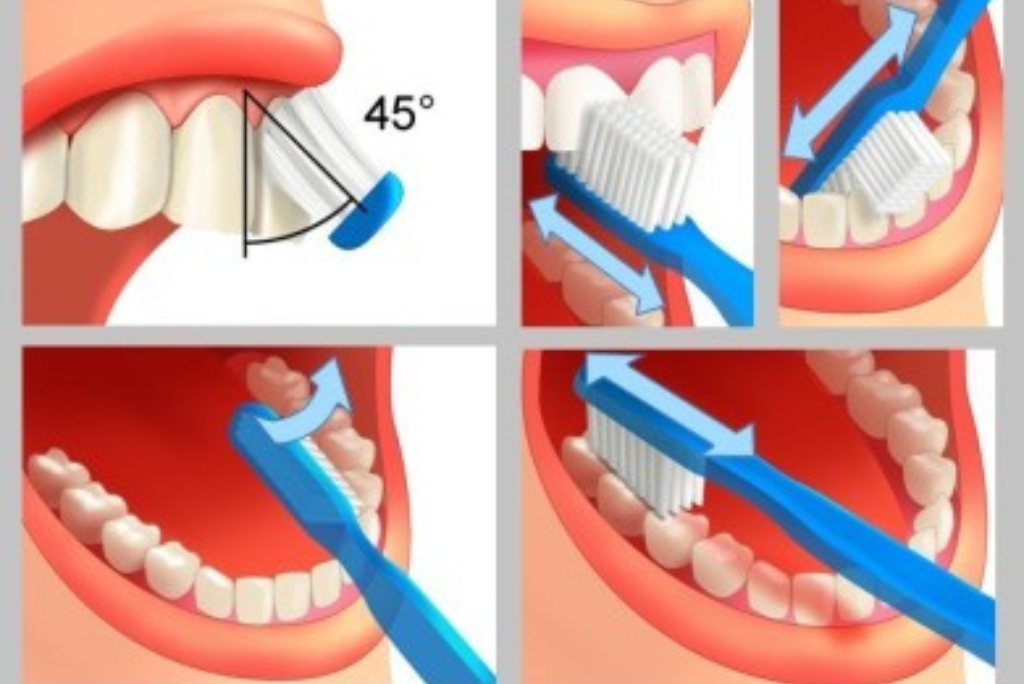 Bien se brosser les dents Dentiste à Fès Dentiste champs de course Dentiste atlas Dentiste centre ville Dentiste prix consultation medecin dentiste maroc